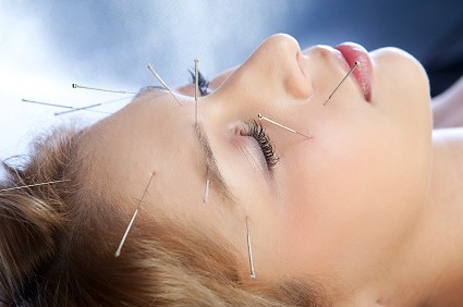 akupunkturun faydaları